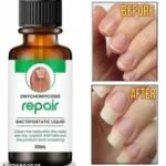Nail Repair Nail Serum for Nail Growth & Repair, Fungal Infection, Anti-infective Removal Paronychia Onychomycosis 30ml